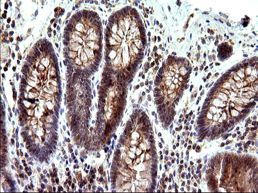 Sex Hormone Binding Globulin Mouse Monoclonal Antibody Clone Id Oti1h10 6794