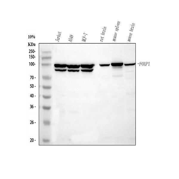 Western blot analysis of FOXP1 using anti-FOXP1 antibody (M00723).