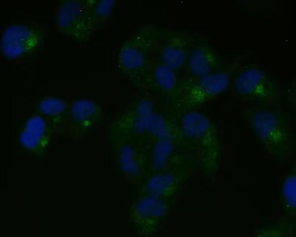 Immunofluorescent analysis of HeLa cells, using Nestin Antibody.