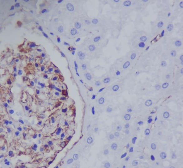 Immunohistochemical analysis of paraffin-embedded human kidney, using Nestin Antibody.