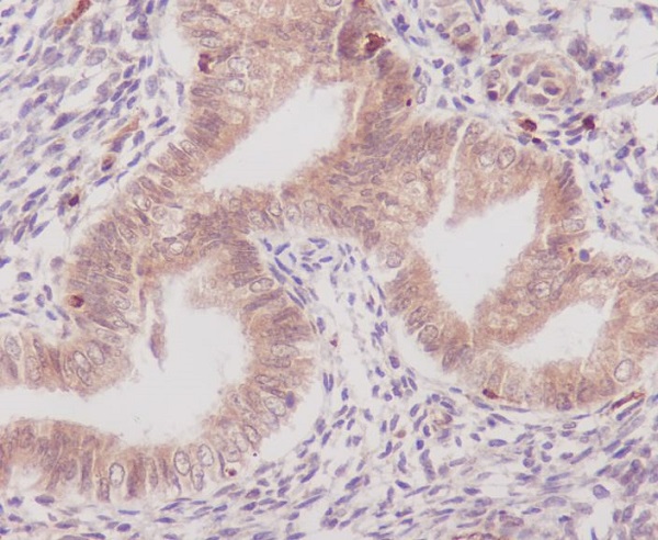 IHC analysis of COX1 using anti-COX1 antibody (M00811) on human uterus. COX1 was detected in paraffin-embedded section. Heat mediated antigen retrieval was performed in citrate buffer (pH6, epitope retrieval solution) for 20 mins. The tissue section was blocked with 10% goat serum. The tissue section was then incubated with 1ug/ml rabbit anti-COX1 Antibody (M00811) overnight at 4°C. Biotinylated goat anti-rabbit IgG was used as secondary antibody and incubated for 30 minutes at 37°C. The tissue section was developed using Strepavidin-Biotin-Complex (SABC)(Catalog # SA1022) with DAB as the chromogen.