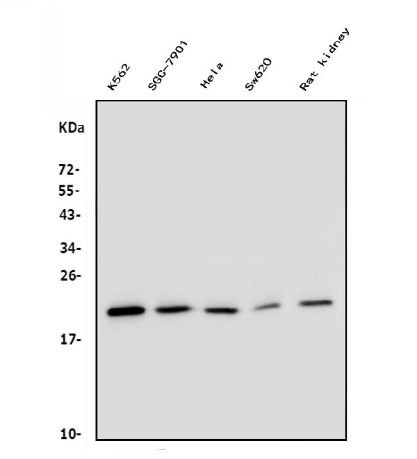 Western blot analysis of DHFR using anti-DHFR antibody (M00813-1).