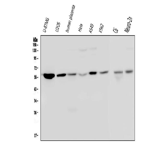 Western blot analysis of Optineurin/OPTN using anti-Optineurin/OPTN antibody (M00952).