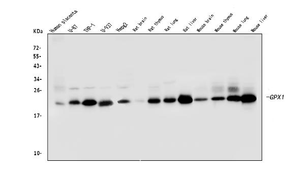 Western blot analysis of GPX1 using anti-GPX1 antibody (M01019-2).