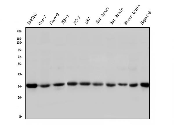 Western blot analysis of STUB1 using anti-STUB1 antibody (M01236).