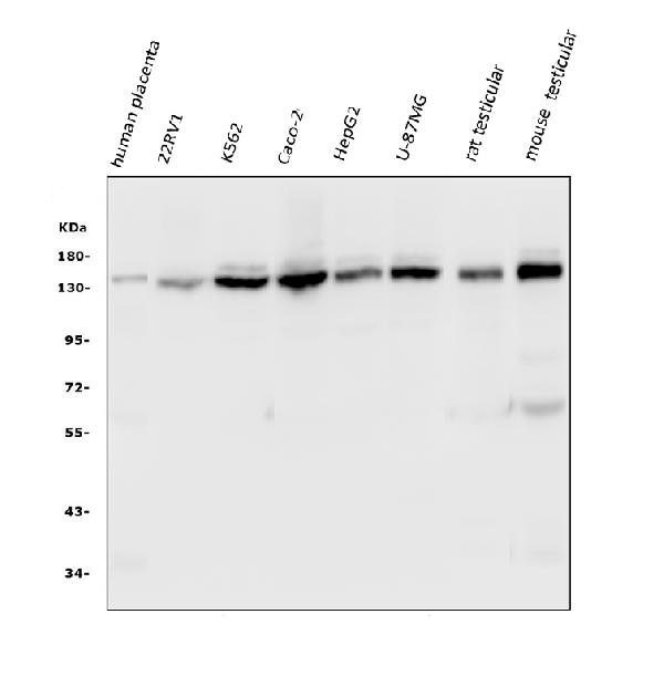 Western blot analysis of HAUSP/USP7 using anti-HAUSP/USP7 antibody (M01239-1).