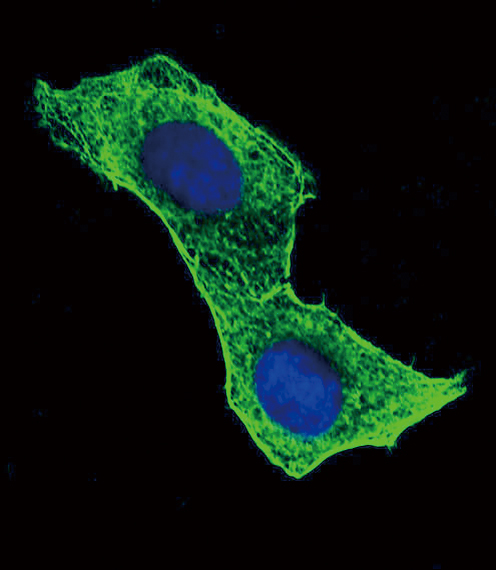 Anti-Beta-Actin Antibody | Boster