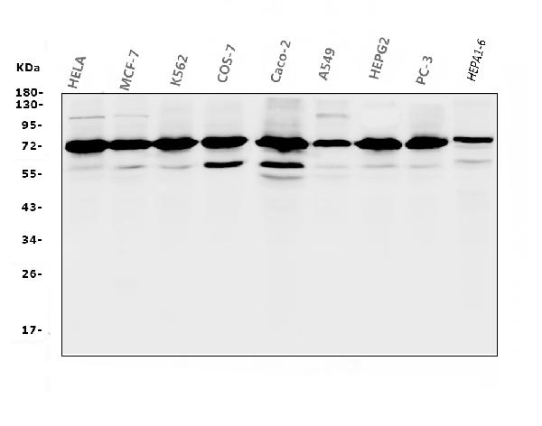 Western blot analysis of RPA70 using anti-RPA70 antibody (M01317-2).