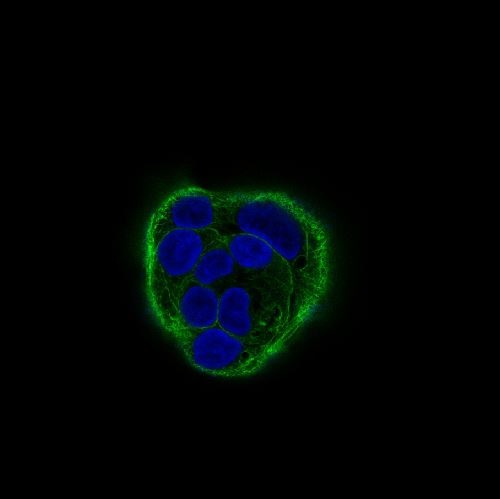 Immunofluorescent analysis of HACAT cells, using Cytokeratin 18 Antibody.