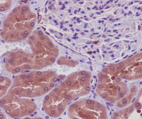 Immunohistochemical analysis of paraffin-embedded human kidney, using PKR Antibody.