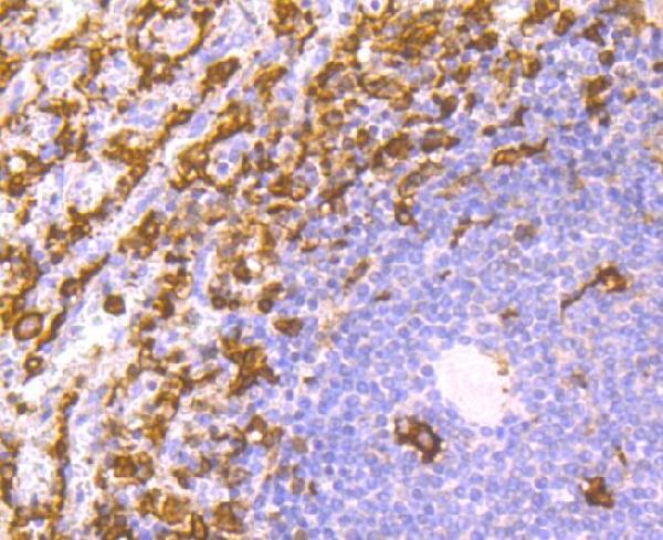 Immunohistochemical analysis of paraffin-embedded human spleen tissue using anti-Iba1 antibody.