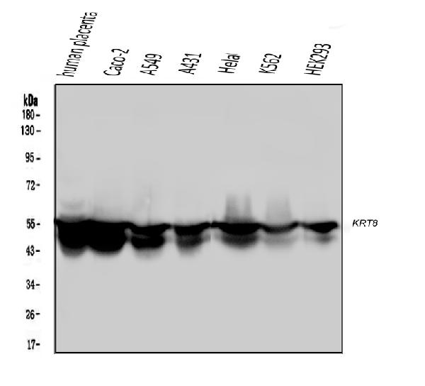 Western blot analysis of Cytokeratin 8 using anti-Cytokeratin 8 antibody (M01421-3).