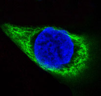 Immunofluorescent analysis of HACAT cells, using Cytokeratin 14 Antibody.