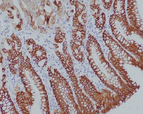 Immunohistochemical analysis of paraffin-embedded human stomach, using Cytokeratin 14 Antibody.