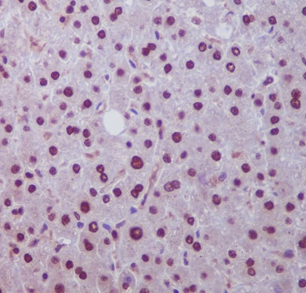 IHC analysis of Hes1 using anti-Hes1 antibody (M01459) on human liver. Hes1 was detected in paraffin-embedded section. Heat mediated antigen retrieval was performed in citrate buffer (pH6, epitope retrieval solution) for 20 mins. The tissue section was blocked with 10% goat serum. The tissue section was then incubated with 1ug/ml rabbit anti-Hes1 Antibody (M01459) overnight at 4°C. Biotinylated goat anti Rabbit IgG IgG antibody was used as secondary antibody and incubated for 30 minutes at 37°C. The tissue section was developed using Strepavidin-Biotin-Complex (SABC)(Catalog # SA1022) with DAB as the chromogen.