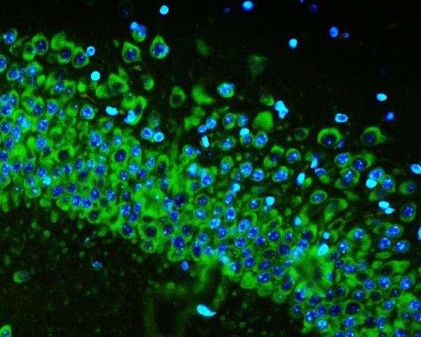 IF analysis of RPS6 using anti-RPS6 antibody (M01567) RPS6 was detected in paraffin-embedded section of rat brain tissues. Heat mediated antigen retrieval was performed in citrate buffer (pH6, epitope retrieval solution) for 20 mins. The tissue section was blocked with 10% goat serum. The tissue section was then incubated with 1μg/mL mouse anti-RPS6 Antibody (M01567) overnight at 4°C. Biotin conjugated goat anti-mouse IgG (BA1001) was used as secondary antibody and incubated for 30 minutes at 37°C. The tissue section was developed using DyLight488 Conjugated Avidin (BA1128). The section was counterstained with DAPI. Visualize using a fluorescence microscope and filter sets appropriate for the label used.