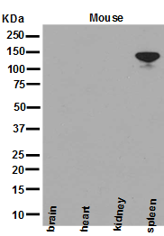 Western blot analysis of NEDD4-2 expression in mouse spleen tissue.