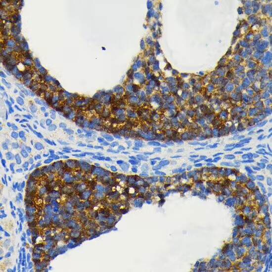 Immunohistochemical analysis of paraffin-embedded rat ovary tissue using anti-BIRC2 antibody. The section was pre-treated using heat mediated antigen retrieval with Tris-EDTA buffer (pH 8.0-8.4) for 20 minutes.The tissues were blocked in 5% BSA for 30 minutes at room temperature, washed with ddH2O and PBS, and then probed with the primary antibody (1/100) for 30 minutes at room temperature.