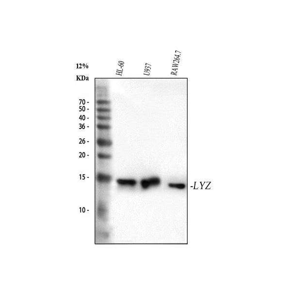 Western blot analysis of Lysozyme using anti-Lysozyme antibody (M01811).