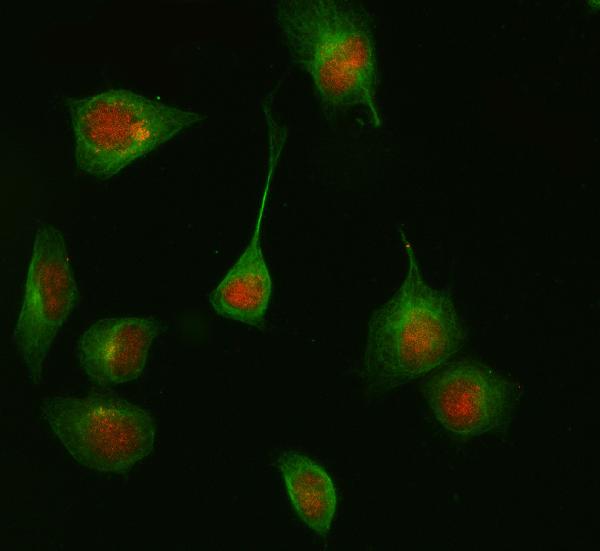 IF analysis of HDAC8 using anti-HDAC8 antibody (M01843-1) and anti-Beta Tubulin antibody (M01857-3).