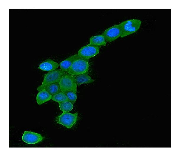 IF analysis of RAB5A using anti-RAB5A antibody (M01891-1).