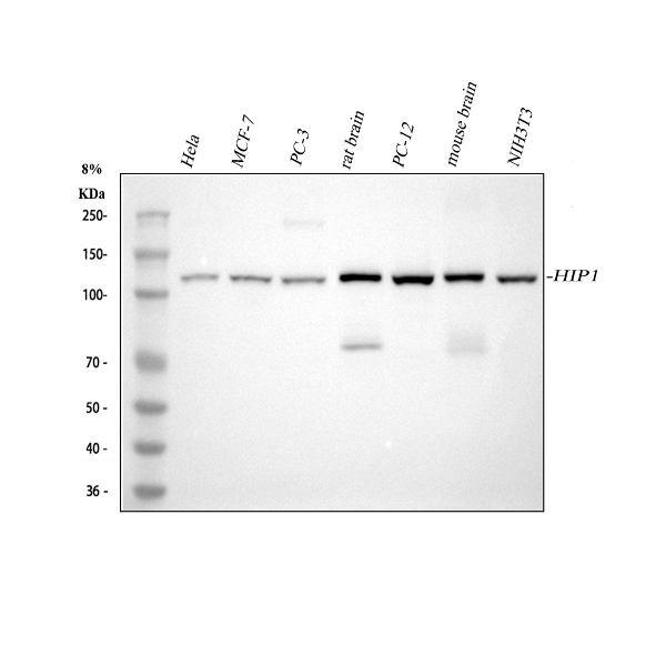 Western blot analysis of HIP1 using anti-HIP1 antibody (M02242).