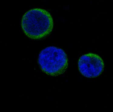 IF analysis of immunocytochemical section of Jurkat cells using anti-Ferritin antibody (M02401) Ferritin was detected in immunocytochemical section. Enzyme antigen retrieval was performed using IHC enzyme antigen retrieval reagent (AR0022) for 15 mins. The tissue section was blocked with 10% goat serum. The tissue section was then incubated with 2μg/mL rabbit anti-Ferritin Antibody (M02401) overnight at 4 °C. DyLight®488 Conjugated Goat AntiRabbit IgG (BA1127) was used as secondary antibody at 1:100 dilution and incubated for 30 minutes at 37 °C. The section was counterstained with DAPI. Visualize using a fluorescence microscope and filter sets appropriate for the label used.