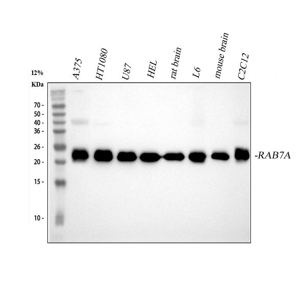 Western blot analysis of RAB7 using anti-RAB7 antibody (M02409).