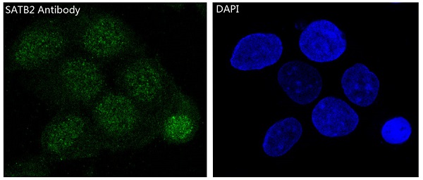 Immunofluorescent analysis of SH-SY5Y cells, using SATB2 Antibody.