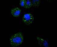 ICC staining of ATF5 in HeLa cells (green). Formalin fixed cells were permeabilized with 0.1% Triton X-100 in TBS for 10 minutes at room temperature and blocked with 1% Blocker BSA for 15 minutes at room temperature. Cells were probed with the primary antibody (1/50) for 1 hour at room temperature, washed with PBS