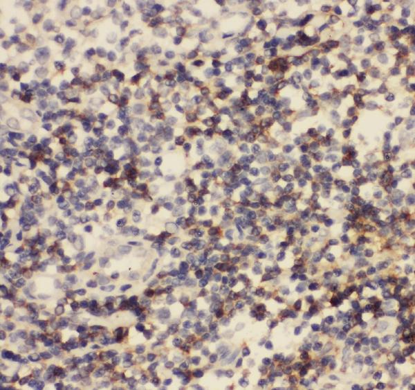 IHC analysis of CD8 using anti-CD8 antibody (MA1017). CD8 was detected in paraffin-embedded section of human tonsil tissues. Heat mediated antigen retrieval was performed in citrate buffer (pH6, epitope retrieval solution) for 20 mins. The tissue section was blocked with 10% goat serum. The tissue section was then incubated with 1μg/ml mouse anti-CD8 Antibody (MA1017) overnight at 4°C. Biotinylated goat anti-mouse IgG was used as secondary antibody and incubated for 30 minutes at 37°C. The tissue section was developed using Strepavidin-Biotin-Complex (SABC)(Catalog # SA1021) with DAB as the chromogen.