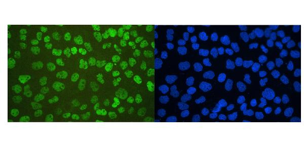 IF analysis of p53 using anti-p53 antibody (MA1078). p53 was detected in immunocytochemical section of A431 cell. Enzyme antigen retrieval was performed using IHC enzyme antigen retrieval reagent (AR0022) for 15 mins. The cells were blocked with 10% goat serum. And then incubated with 2μg/mL mouse anti-p53 Antibody (MA1078) overnight at 4°C. DyLight®488 Conjugated Goat Anti-Mouse IgG (BA1126) was used as secondary antibody at 1:100 dilution and incubated for 30 minutes at 37°C. The section was counterstained with DAPI. Visualize using a fluorescence microscope and filter sets appropriate for the label used.