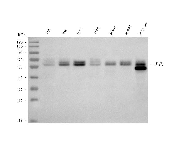 Western blot analysis of Paxillin using anti-Paxillin antibody (MA1080).