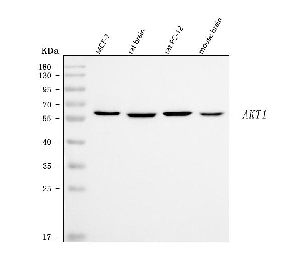 Western blot analysis of PKB alpha using anti-PKB alpha antibody (MA1085).