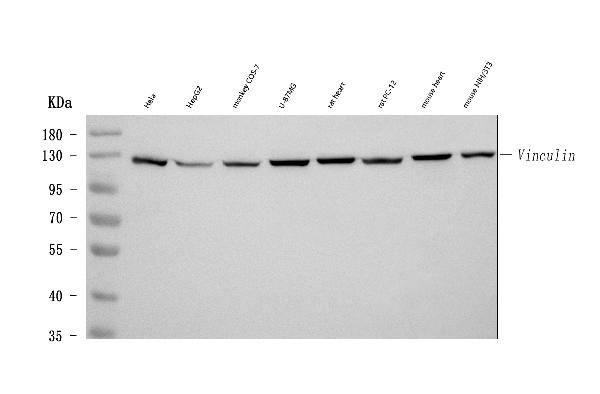 Western blot analysis of Vinculin using anti-Vinculin antibody (MA1103).