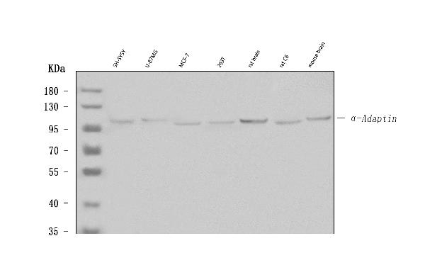 Western blot analysis of α-Adaptin using anti-α-Adaptin antibody (MA1105).