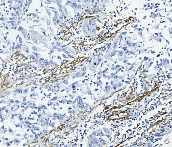 IHC analysis of Alpha-Smooth Muscle Actin using anti-Alpha-Smooth Muscle Actin antibody (MA1106).