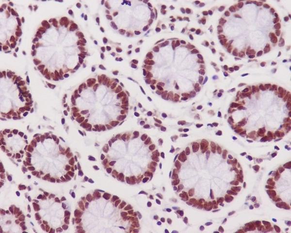 Immunohistochemical analysis of paraffin-embedded human colon tissue using anti-Phospho-DNA PKcs (S2056) antibody. The section was pre-treated using heat mediated antigen retrieval with Tris-EDTA buffer (pH 9.0) for 20 minutes.The tissues were blocked in 5% BSA for 30 minutes at room temperature, washed with ddH2O and PBS, and then probed with the primary antibody (1/200) for 30 minutes at room temperature. The detection was performed using an HRP conjugated compact polymer system. DAB was used as the chromogen. Tissues were counterstained with hematoxylin and mounted with DPX.