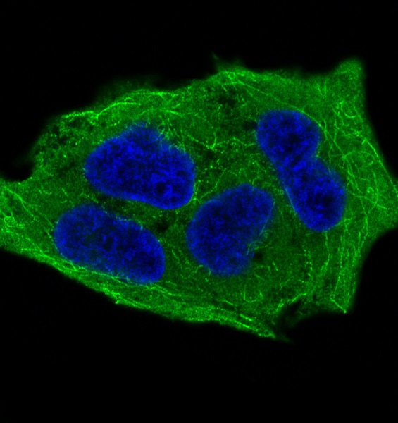 IF analysis of immunocytochemical section of HeLa cells treated with Calyculin A using anti-Phospho-GSK3 beta (Ser9) antibody (P00791-1) Phospho-GSK3 beta (Ser9) was detected in immunocytochemical section. Enzyme antigen retrieval was performed using IHC enzyme antigen retrieval reagent (AR0022) for 15 mins. The tissue section was blocked with 10% goat serum. The tissue section was then incubated with 2μg/mL rabbit anti-Phospho-GSK3 beta (Ser9) Antibody (P00791-1) overnight at 4 &deg