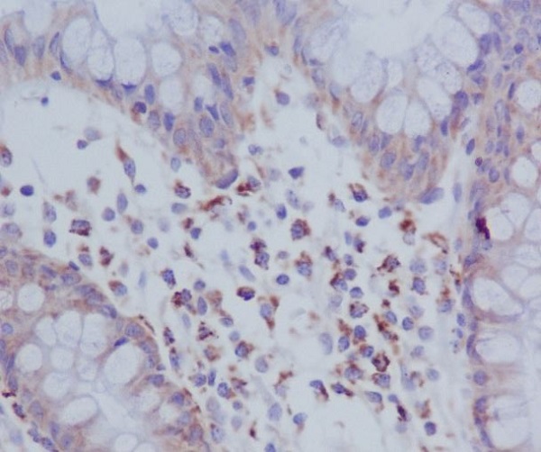 Immunohistochemical analysis of paraffin-embedded human colon, using Phospho-PKR (T446) Antibody.