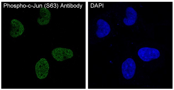 IF analysis of immunocytochemical section of HeLa cells treated with anisomycin using anti-Phospho-c-Jun (S63) antibody (P02038) Phospho-c-Jun (S63) was detected in immunocytochemical section. Enzyme antigen retrieval was performed using IHC enzyme antigen retrieval reagent (AR0022) for 15 mins. The tissue section was blocked with 10% goat serum. The tissue section was then incubated with 2μg/mL rabbit anti-Phospho-c-Jun (S63) Antibody (P02038) overnight at 4 °C. DyLight®488 Conjugated Goat AntiRabbit IgG (BA1127) was used as secondary antibody at 1:100 dilution and incubated for 30 minutes at 37 °C. The section was counterstained with DAPI. Visualize using a fluorescence microscope and filter sets appropriate for the label used.