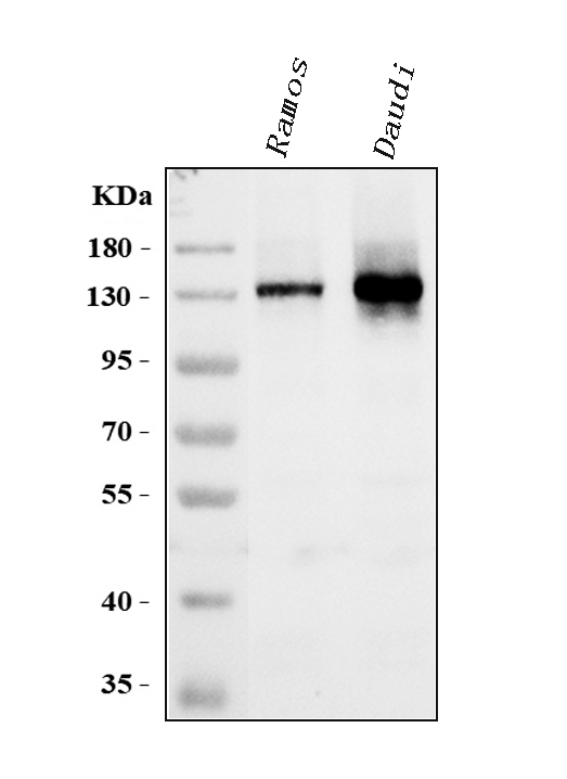 Western blot analysis of CD22 using anti-CD22 antibody (PA1018-1).