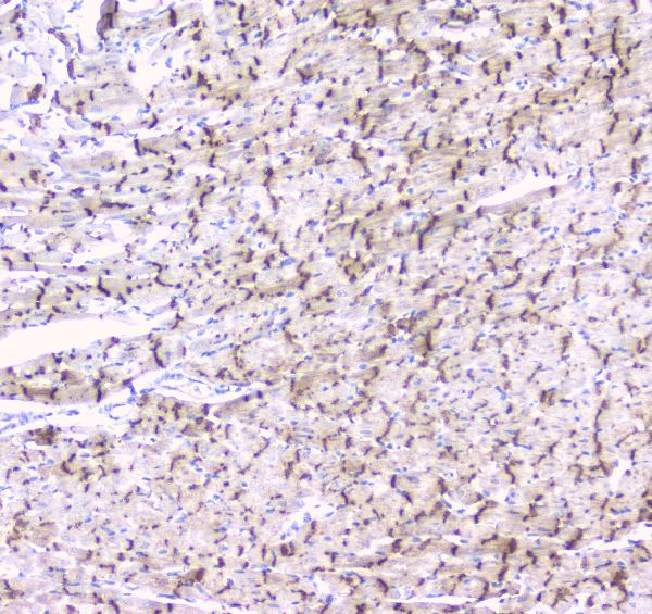 IHC analysis of Connexin 43/GJA1 using anti-Connexin 43/GJA1 antibody (PA1026-1). Connexin 43/GJA1 was detected in paraffin-embedded section of rat cardiac muscle tissues. Heat mediated antigen retrieval was performed in citrate buffer (pH6, epitope retrieval solution) for 20 mins. The tissue section was blocked with 10% goat serum. The tissue section was then incubated with 1μg/ml rabbit anti-Connexin 43/GJA1 Antibody (PA1026-1) overnight at 4°C. Biotinylated goat anti-rabbit IgG was used as secondary antibody and incubated for 30 minutes at 37°C. The tissue section was developed using Strepavidin-Biotin-Complex (SABC)(Catalog # SA1022) with DAB as the chromogen.