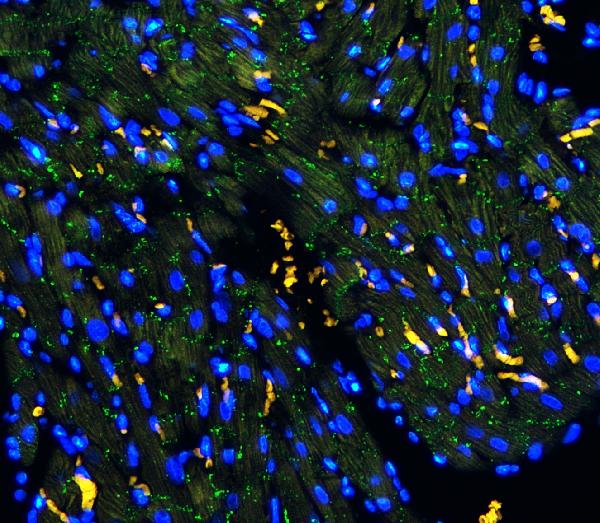 IF analysis of Connexin 43/GJA1 using anti-Connexin 43/GJA1 antibody (PA1026). Connexin 43/GJA1 was detected in paraffin-embedded section of rat heart tissues. Heat mediated antigen retrieval was performed in citrate buffer (pH6, epitope retrieval solution ) for 20 mins. The tissue section was blocked with 10% goat serum. The tissue section was then incubated with 1μg/mL rabbit anti-Connexin 43/GJA1 Antibody (PA1026) overnight at 4°C. DyLight®488 Conjugated Goat Anti-Rabbit IgG (BA1127) was used as secondary antibody at 1:100 dilution and incubated for 30 minutes at 37°C.. Visualize using a fluorescence microscope and filter sets appropriate for the label used.