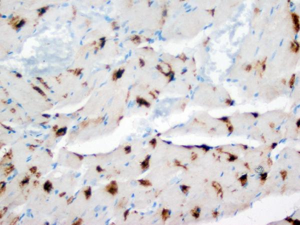 IHC analysis of DUT using anti-DUT antibody (PA1030-1). DUT was detected in paraffin-embedded section of rat heart tissues. Heat mediated antigen retrieval was performed in citrate buffer (pH6, epitope retrieval solution) for 20 mins. The tissue section was blocked with 10% goat serum. The tissue section was then incubated with 1μg/ml rabbit anti-DUT Antibody (PA1030-1) overnight at 4°C. Biotinylated goat anti-rabbit IgG was used as secondary antibody and incubated for 30 minutes at 37°C. The tissue section was developed using Strepavidin-Biotin-Complex (SABC)(Catalog # SA1022) with DAB as the chromogen.