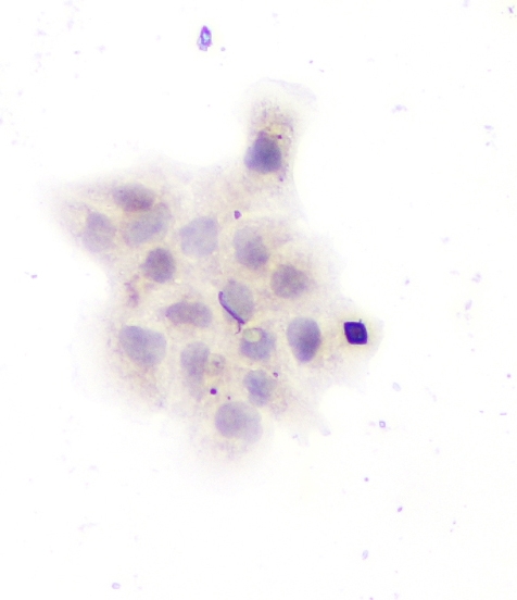 IHC analysis of GAD67 using anti-GAD67 antibody (PA1036-1). GAD67 was detected in immunocytochemical section of A431 cells. Enzyme antigen retrieval was performed using IHC enzyme antigen retrieval reagent (AR0022) for 15 mins. The cells were blocked with 10% goat serum. And then incubated with 3μg/ml rabbit anti-GAD67 Antibody (PA1036-1) overnight at 4°C. Biotinylated goat anti-rabbit IgG was used as secondary antibody and incubated for 30 minutes at 37°C. The section was developed using Strepavidin-Biotin-Complex (SABC)(Catalog # SA1022) with DAB as the chromogen.