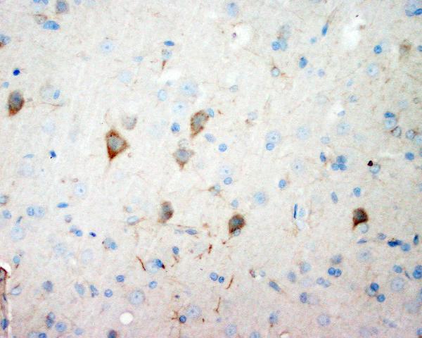 IHC analysis of NSE using anti-NSE antibody (PA1061). NSE was detected in paraffin-embedded section of rat brain tissue. Heat mediated antigen retrieval was performed in citrate buffer (pH6, epitope retrieval solution) for 20 mins. The tissue section was blocked with 10% goat serum. The tissue section was then incubated with 1μg/ml rabbit anti-NSE Antibody (PA1061) overnight at 4°C. Biotinylated goat anti-rabbit IgG was used as secondary antibody and incubated for 30 minutes at 37°C. The tissue section was developed using Strepavidin-Biotin-Complex (SABC)(Catalog # SA1022) with DAB as the chromogen.