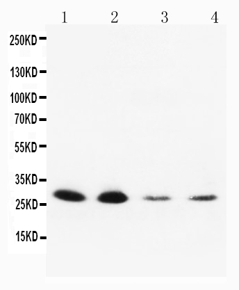 Anti-Neurotrophin 3 antibody, PA1062, Western blotting Lane 1: Rat Brain Tissue Lysate Lane 2: Rat Brain Tissue Lysate Lane 3: MCF-7 Cell Lysate Lane 4: HELA Cell Lysate