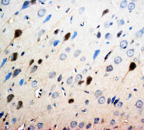 Anti-Neurotrophin 3 antibody, PA1062, IHC(P) IHC(P): Rat Brain Tissue