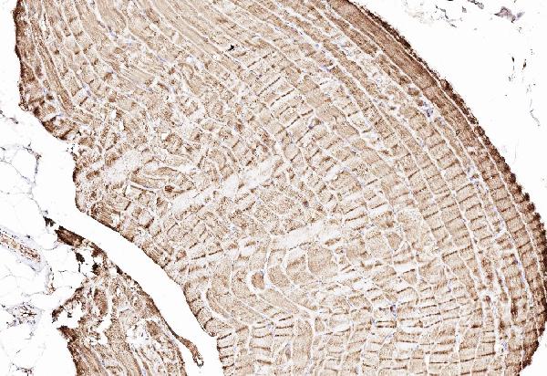 IHC analysis of Cytochrome C using anti-Cytochrome C antibody (PA1118). Cytochrome C was detected in paraffin-embedded section of human skeletal muscle tissues. Heat mediated antigen retrieval was performed in citrate buffer (pH6, epitope retrieval solution) for 20 mins. The tissue section was blocked with 10% goat serum. The tissue section was then incubated with 1μg/ml rabbit anti-Cytochrome C Antibody (PA1118) overnight at 4°C. Biotinylated goat anti-rabbit IgG was used as secondary antibody and incubated for 30 minutes at 37°C. The tissue section was developed using Strepavidin-Biotin-Complex (SABC)(Catalog # SA1022) with DAB as the chromogen.